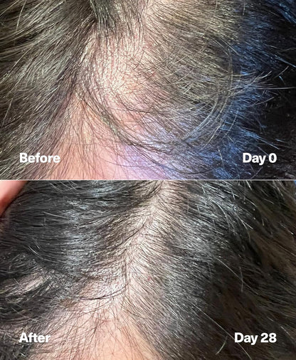 SickScience* PowerCycle Exosome Hair Growth Serum - Clinically Advanced Scalp Treatment for Thinning Hair