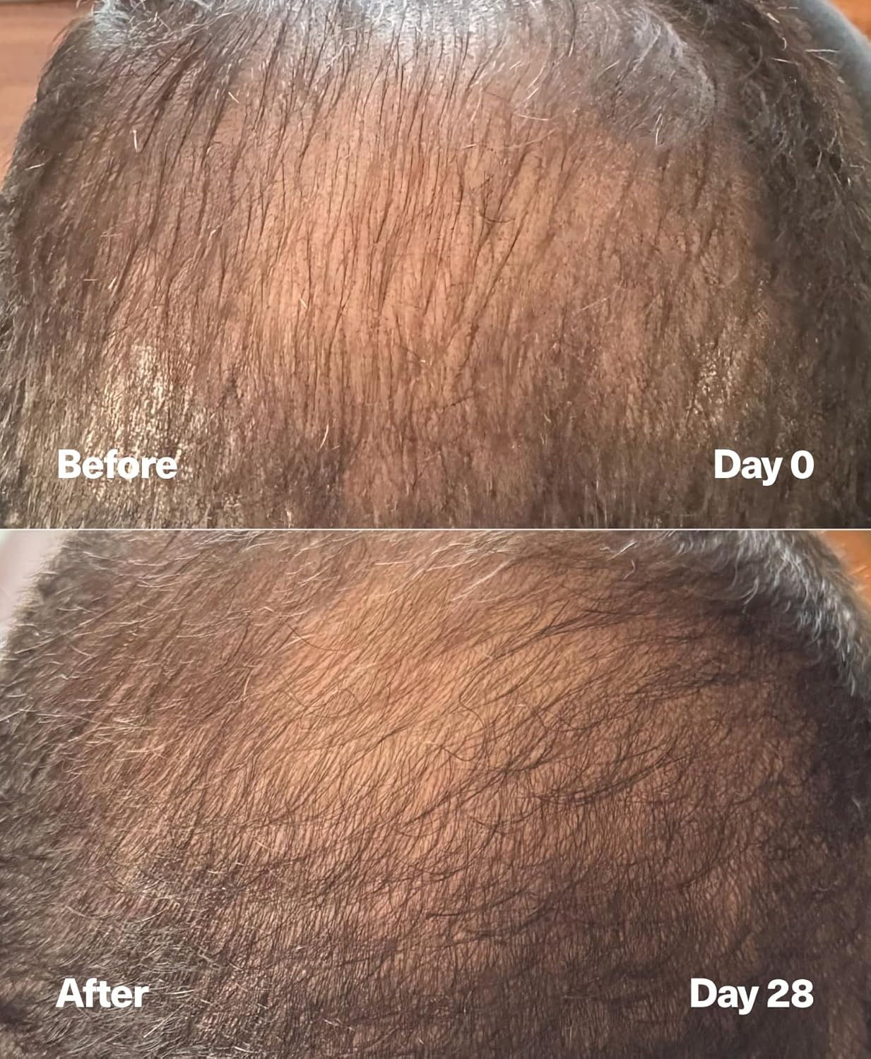 SickScience* PowerCycle Exosome Hair Growth Serum - Clinically Advanced Scalp Treatment for Thinning Hair