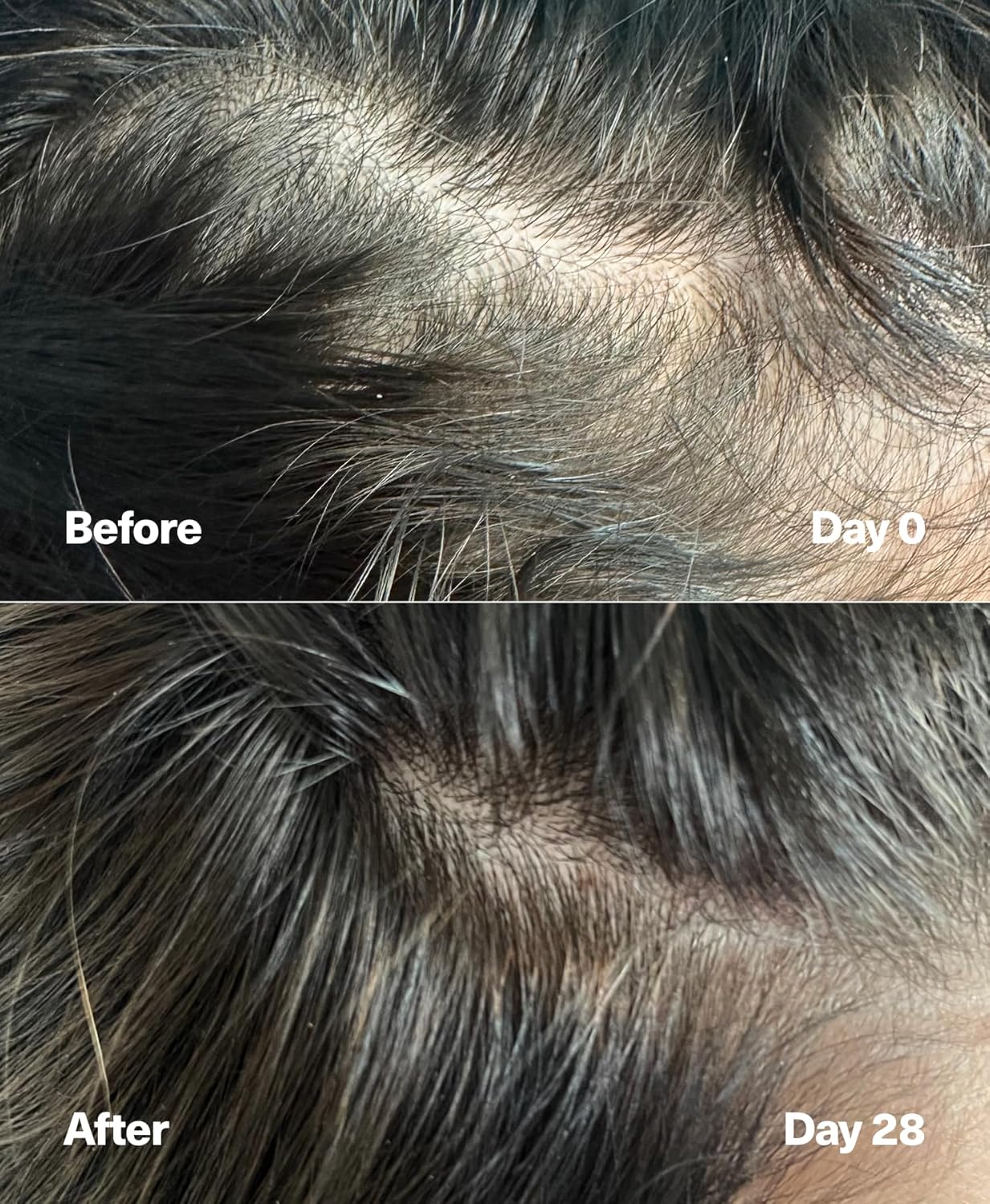 SickScience* PowerCycle Exosome Hair Growth Serum - Clinically Advanced Scalp Treatment for Thinning Hair