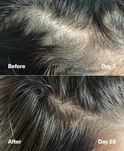 SickScience* PowerCycle Exosome Hair Growth Serum - Clinically Advanced Scalp Treatment for Thinning Hair